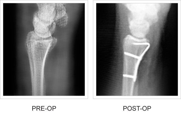 Pre and post-op x-rays