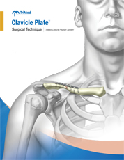 Superior Midshaft Clavicle Plate surgical technique manual cover