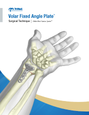 Volar Fixed Angle Plate surgical technique manual cover