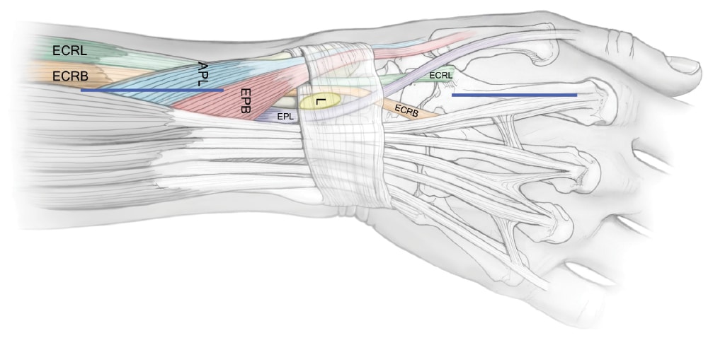 X-ray of the wrist