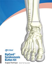 RipCord surgical technique manual cover